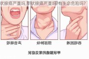 甲状腺癌严重吗,甲状腺癌严重吗?有生命危险吗?