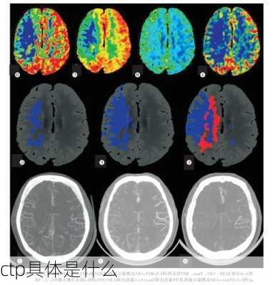ctp具体是什么