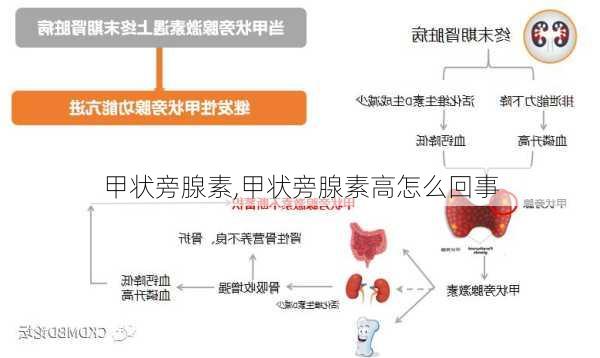 甲状旁腺素,甲状旁腺素高怎么回事