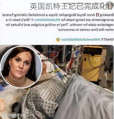 英国凯特王妃已完成化疗
